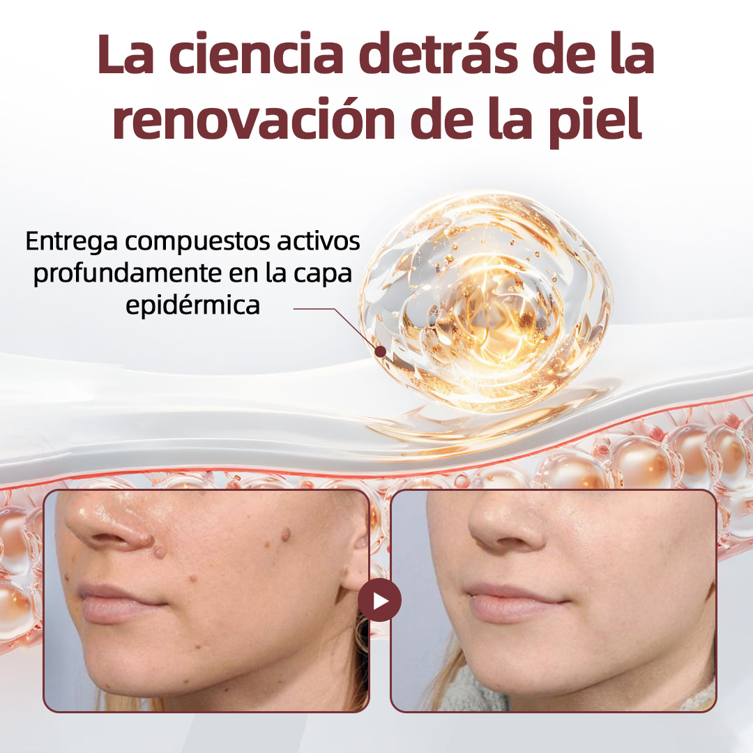 Tienda oficial🩺丨 CureVivo® KeraErase Crema Renovadora de Doble Acción🎯🎯🎯