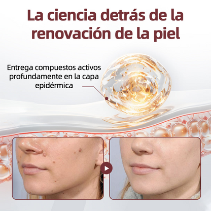 Tienda oficial🩺丨 CureVivo® KeraErase Crema Renovadora de Doble Acción🎯🎯🎯