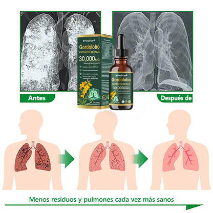 Oficial | Healrize® Limpieza pulmonar orgánica  Gordolobo  Extracto de hoja  Gotas 🎀 Fórmula clínicamente probada y altamente concentrada que alivia la tos, la flema, el asma y la EPOC: respire mejor y más rápido.💎
