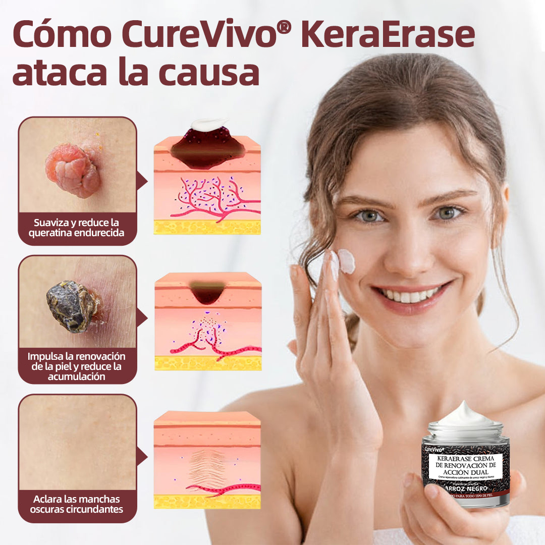 Tienda oficial🩺丨 CureVivo® KeraErase Crema Renovadora de Doble Acción🎯🎯🎯