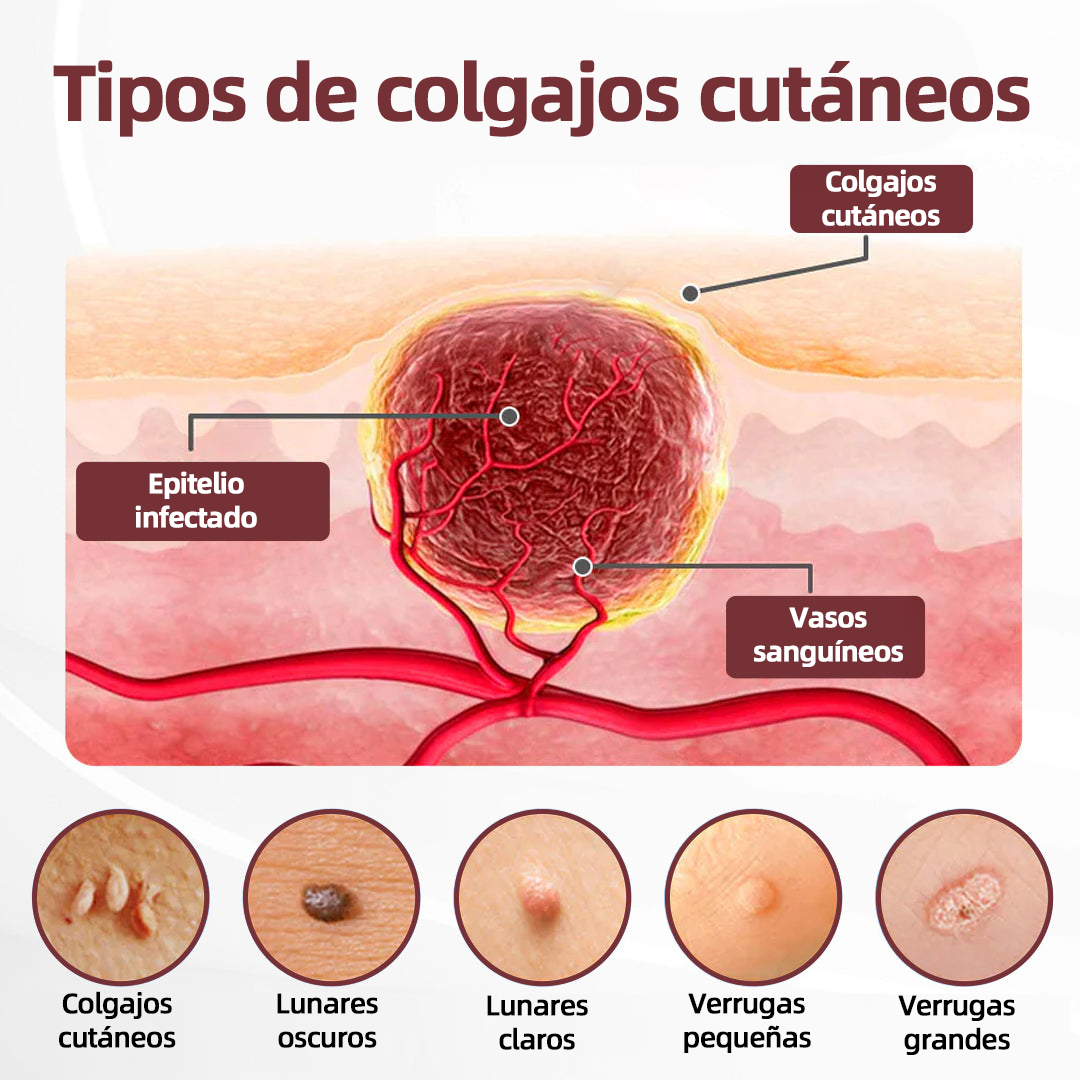 Tienda oficial🩺丨 CureVivo® KeraErase Crema Renovadora de Doble Acción🎯🎯🎯