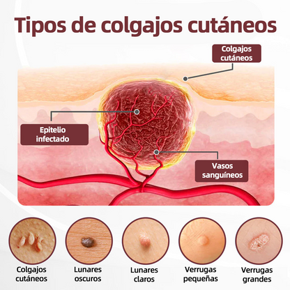 Tienda oficial🩺丨 CureVivo® KeraErase Crema Renovadora de Doble Acción🎯🎯🎯